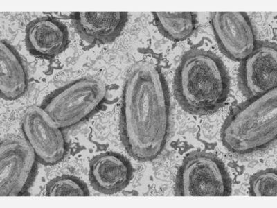 Camden County Detects Its First Case Of Monkeypox